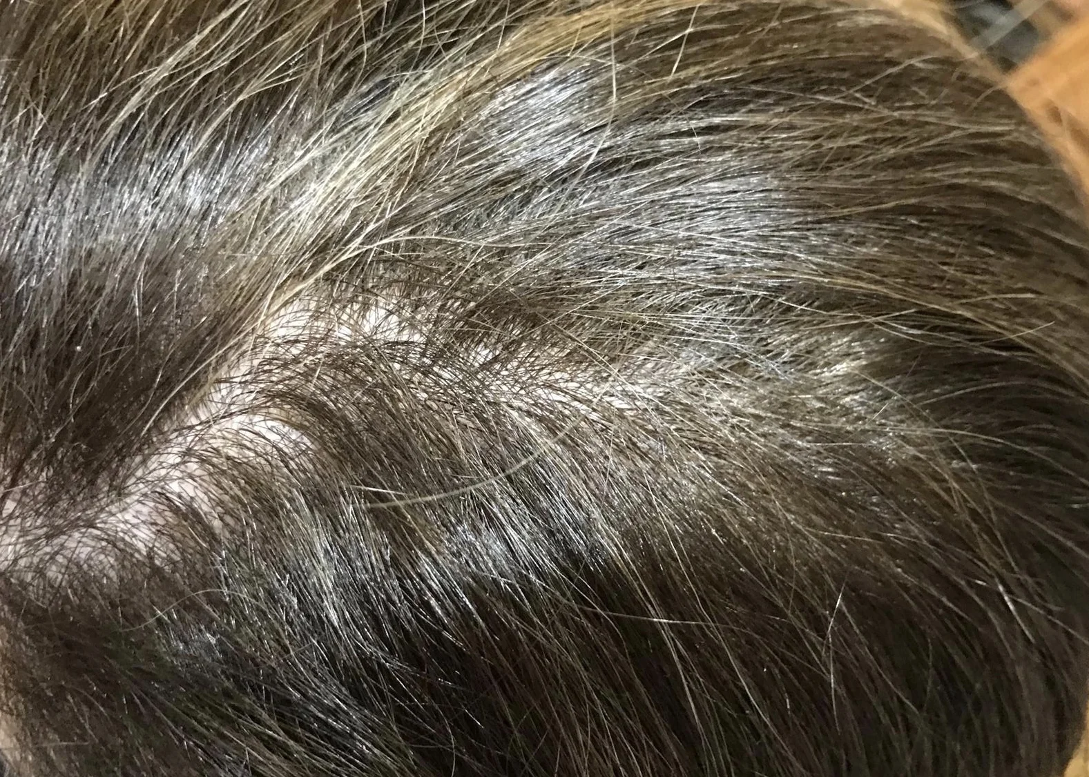 AFTER 2 MONTHS (UNEDITED)