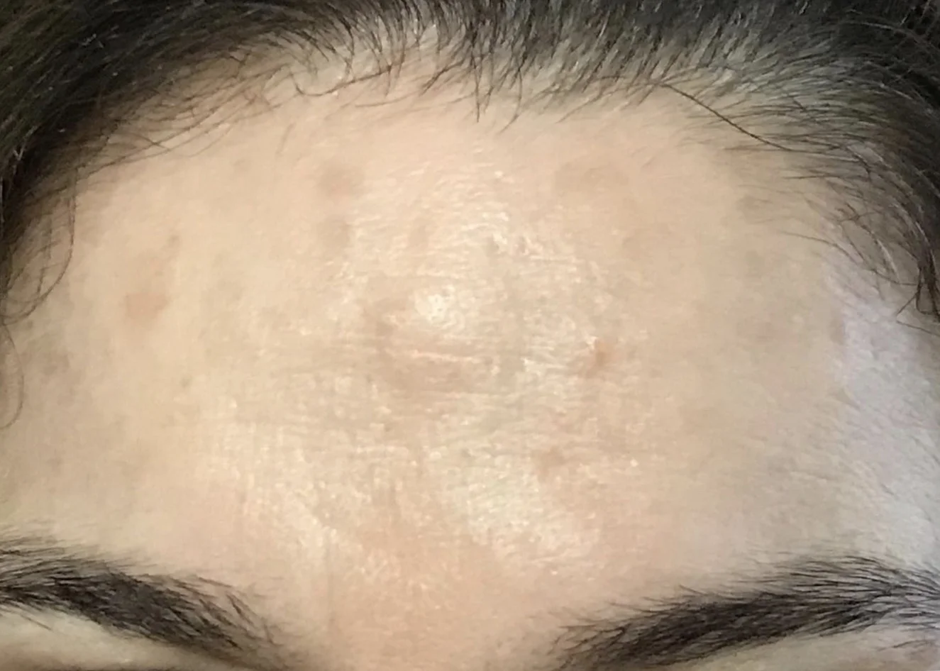 AFTER 2 MONTHS (UNEDITED)