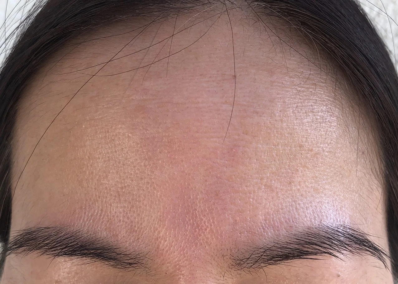 AFTER 2.5 MONTHS (UNEDITED)