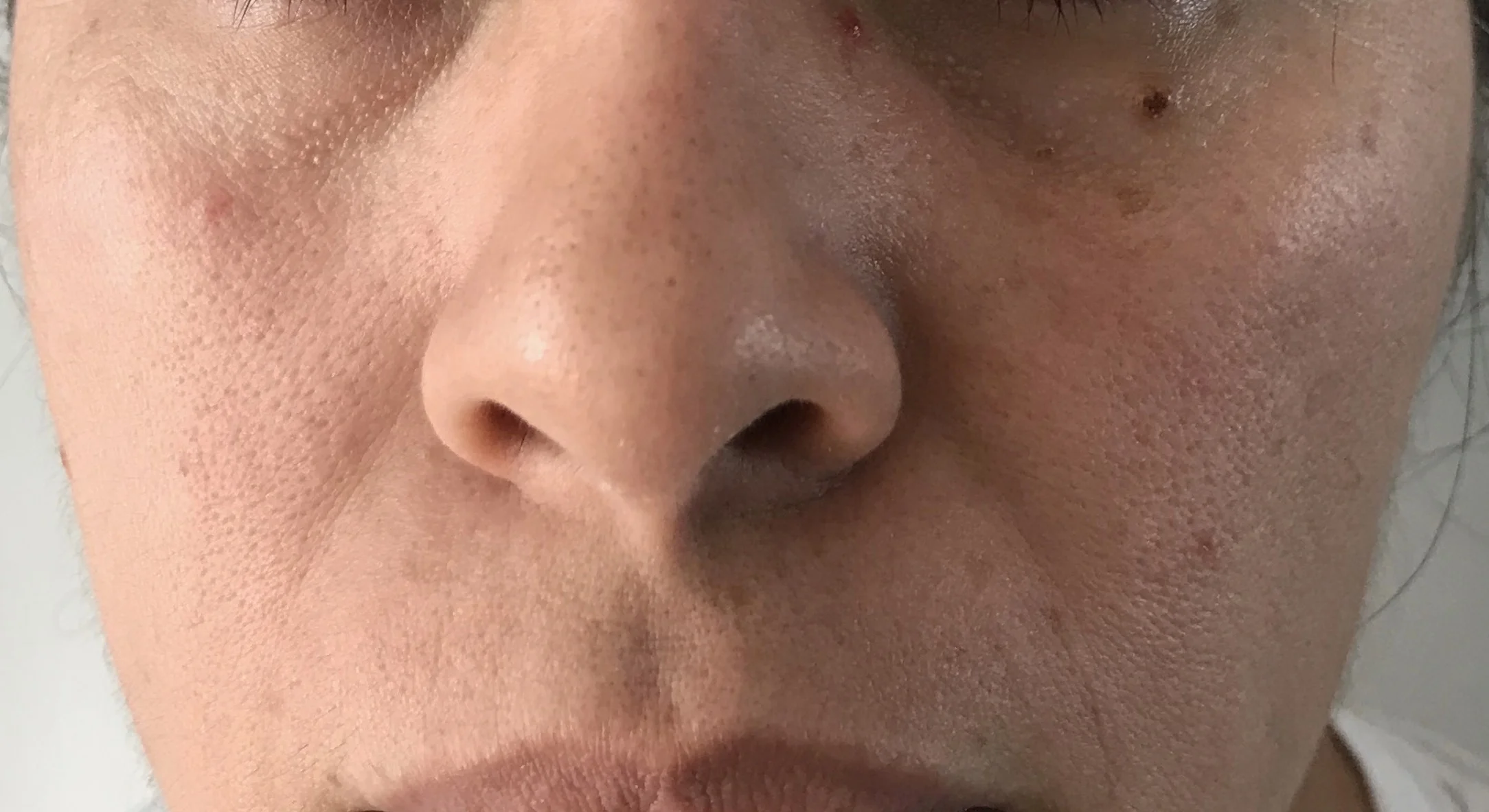 BEFORE (UNEDITED)