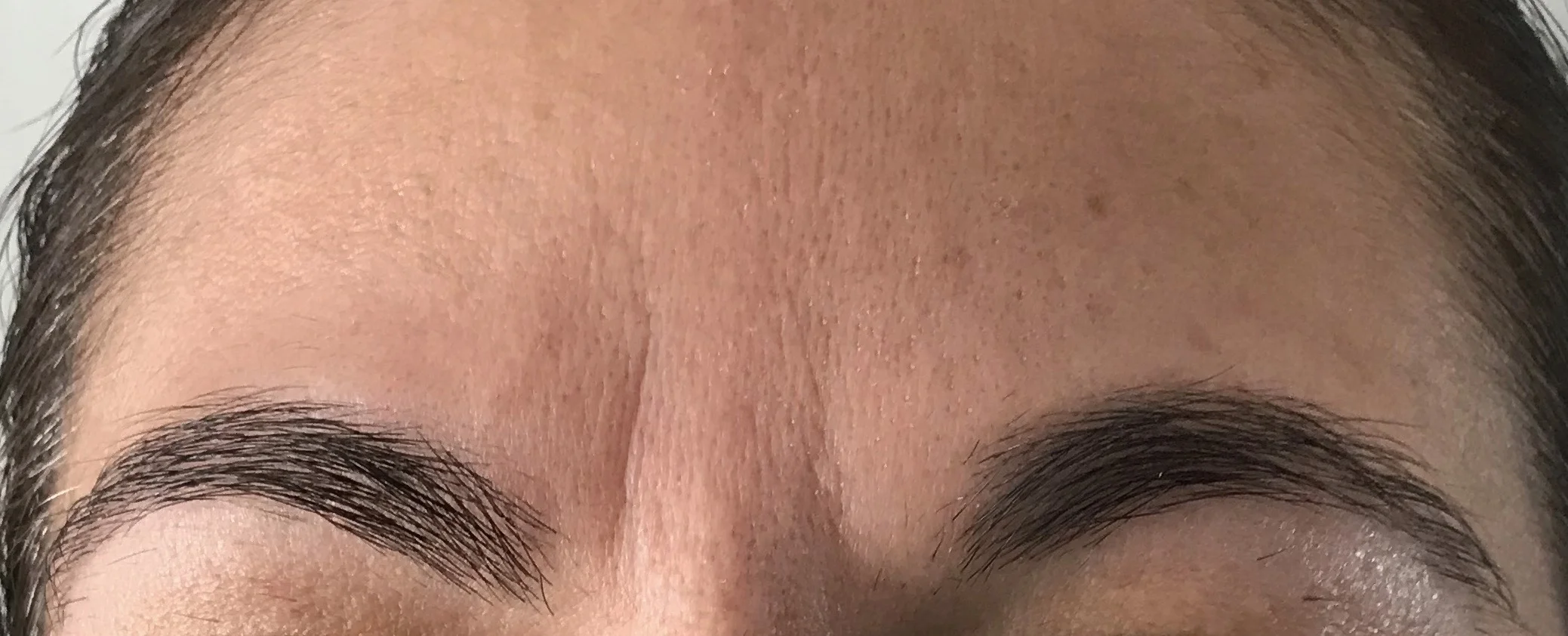 BEFORE (UNEDITED)