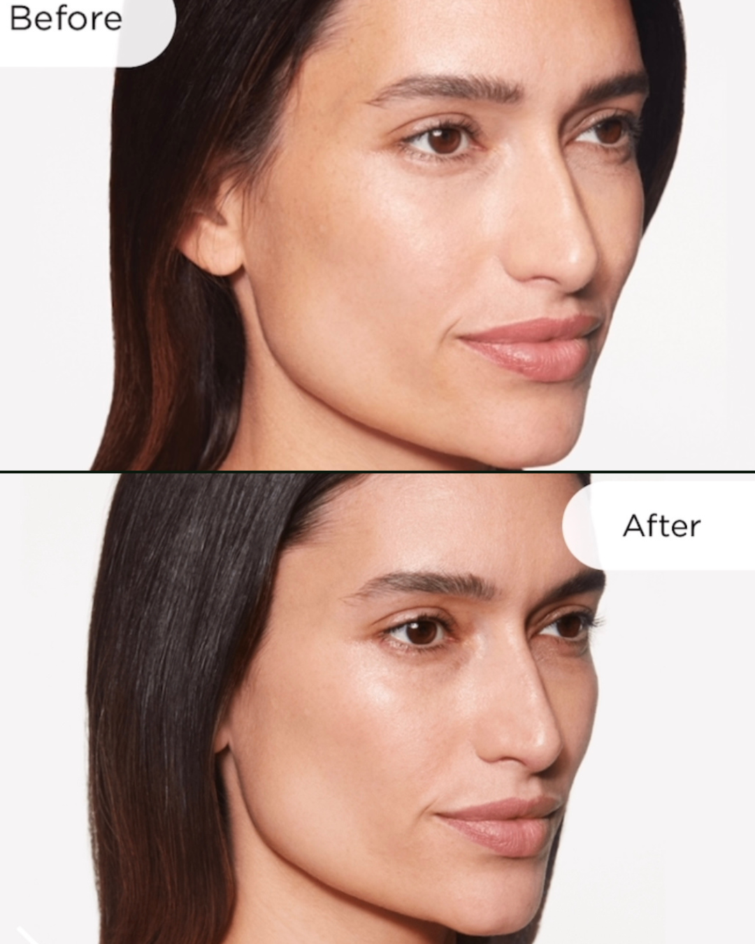 Beige Minimalist Beauty Before After Collage Instagram Post.zip - 1.PNG