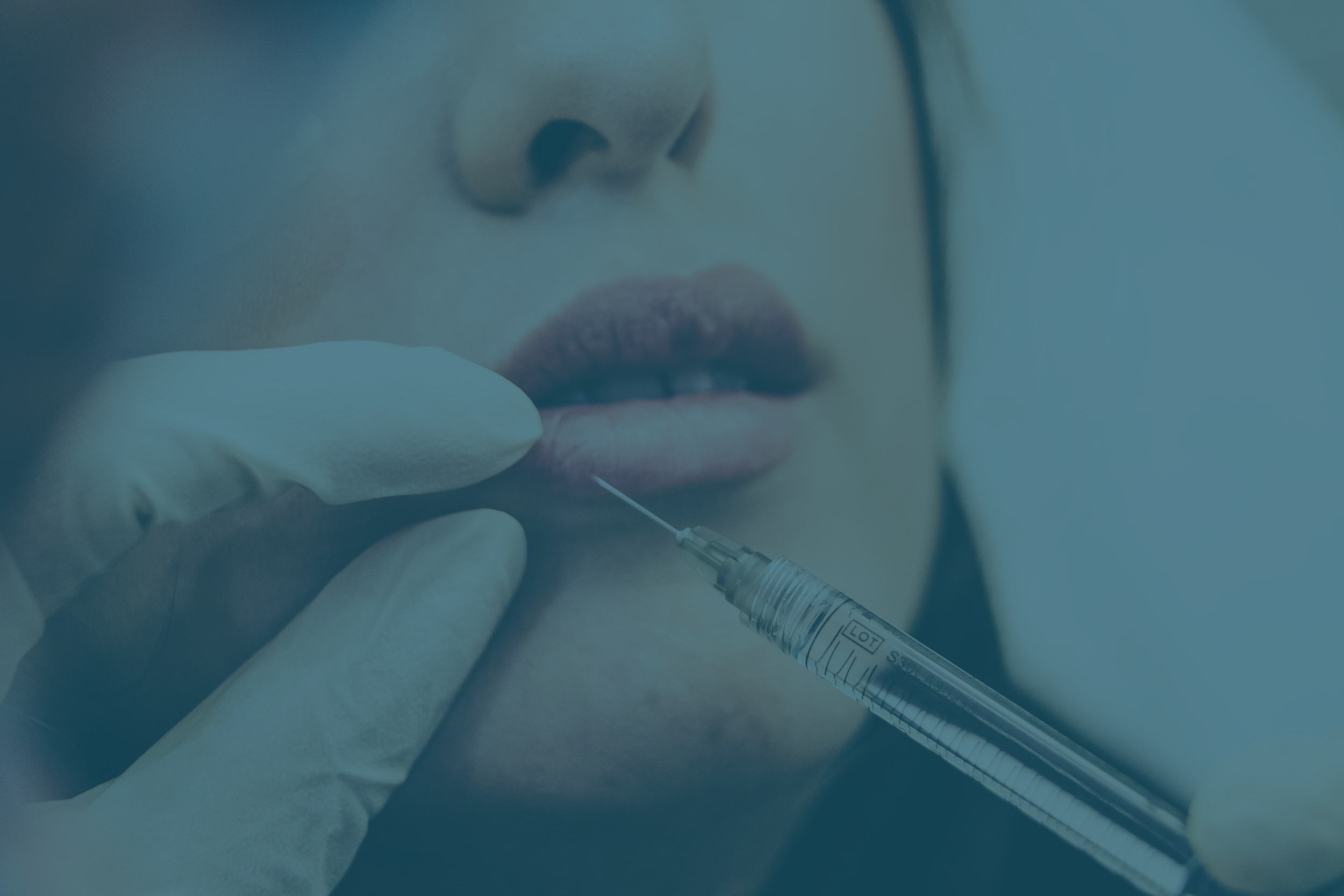 Injection Acide Hyaluronique 