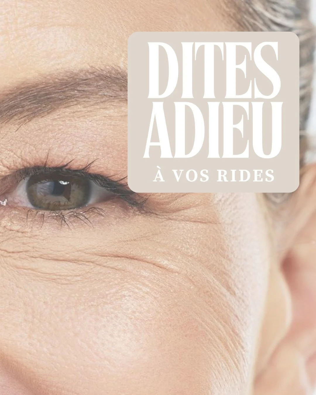 ✨ Le peeling contre les rides est un soin esth&eacute;tique qui exfolie en douceur la couche superficielle de la peau &agrave; l&rsquo;aide d&rsquo;acides doux.
Il stimule le renouvellement cellulaire 🔄 et la production de collag&egrave;ne, ce qui p