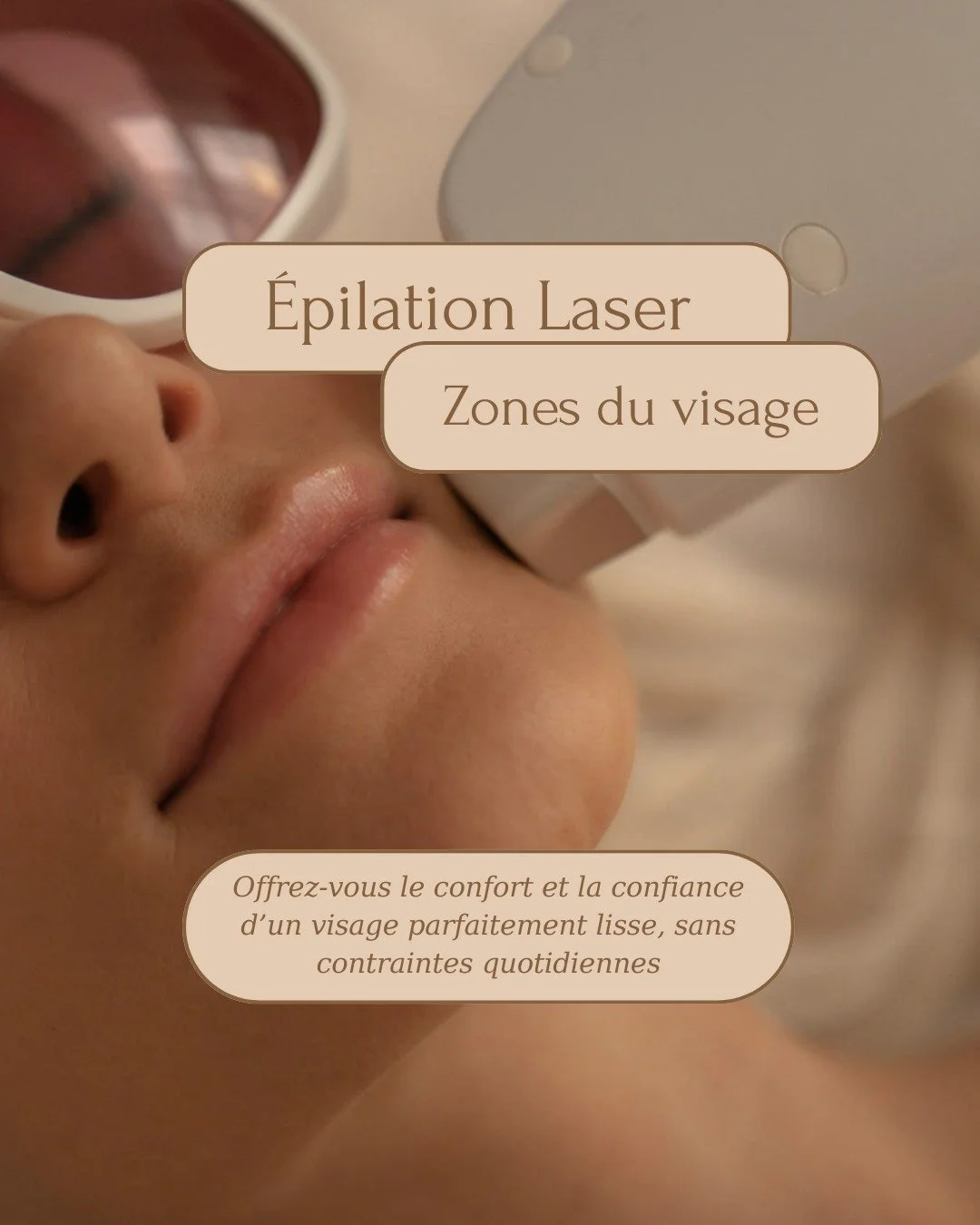 L&rsquo;&eacute;pilation laser ne concerne pas seulement les jambes !
🌸🌸Au cabinet, nous proposons &eacute;galement le traitement des zones du visage et du cou, souvent sources d&rsquo;inconfort ou de complexes.

#&Eacute;pilationLaser #LaserVisage