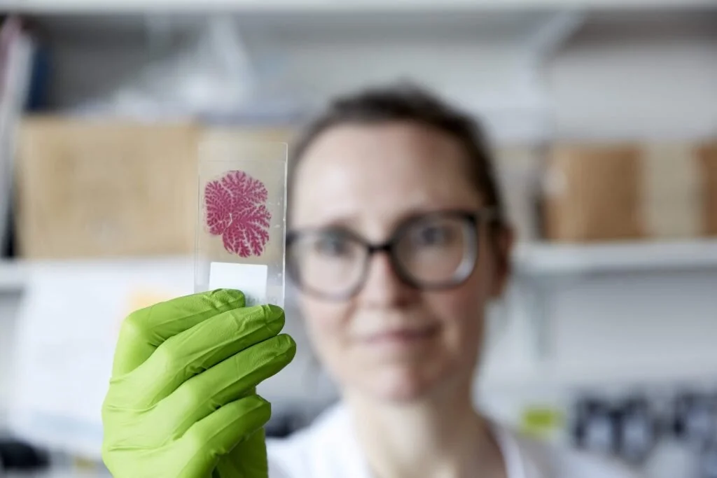 BRACE Protects Vital Dementia Research