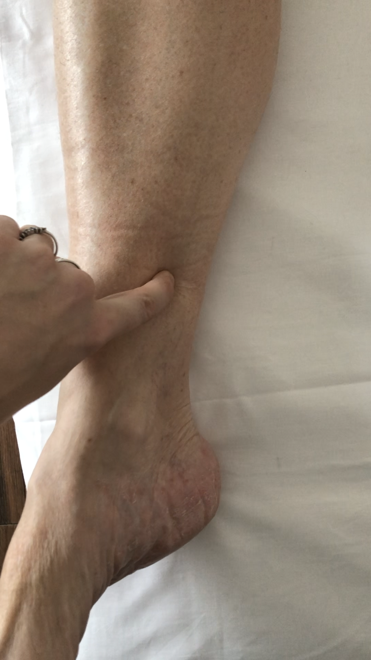 Acupuncture Foresthill