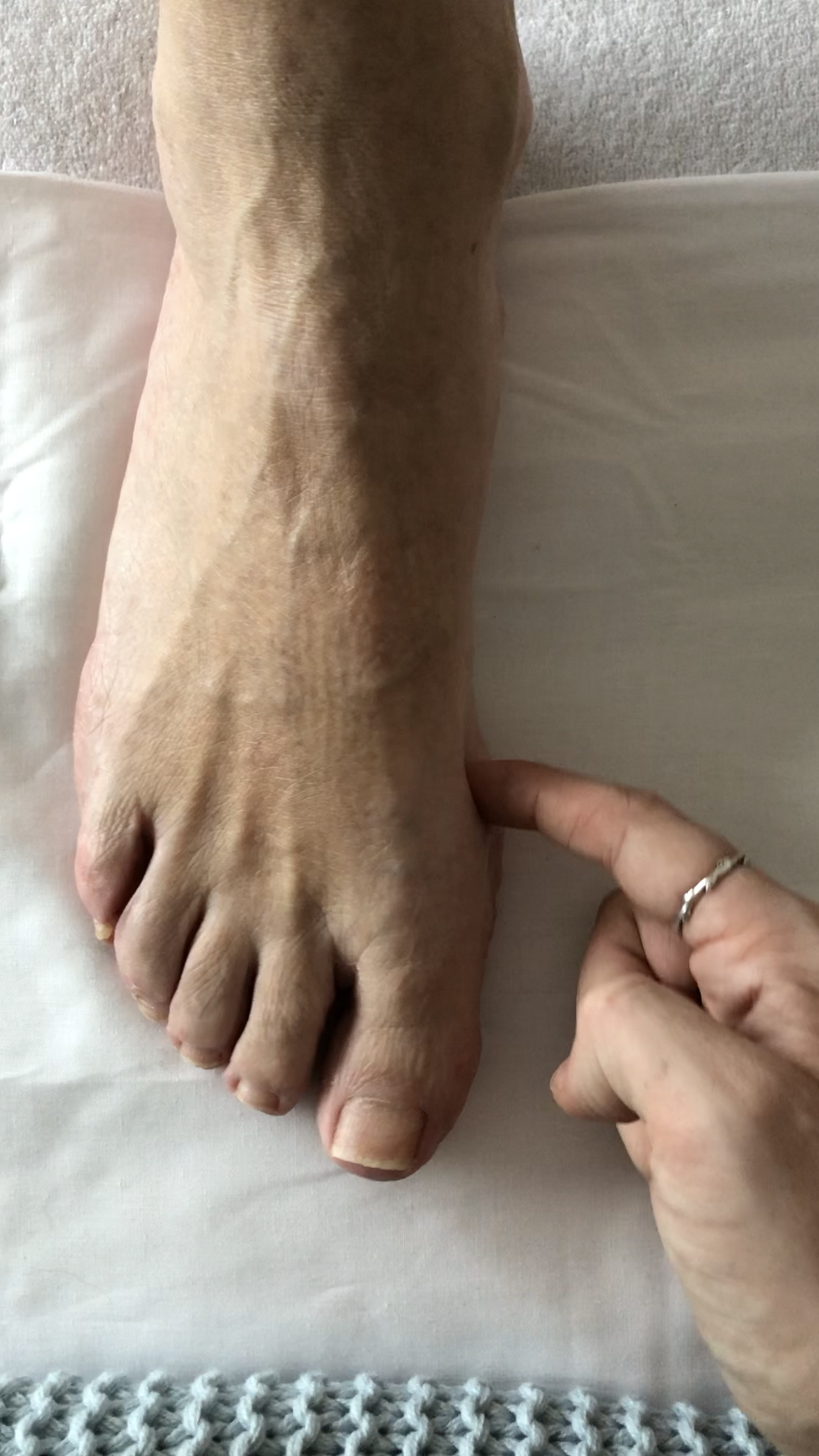 Acupuncture Sydenham