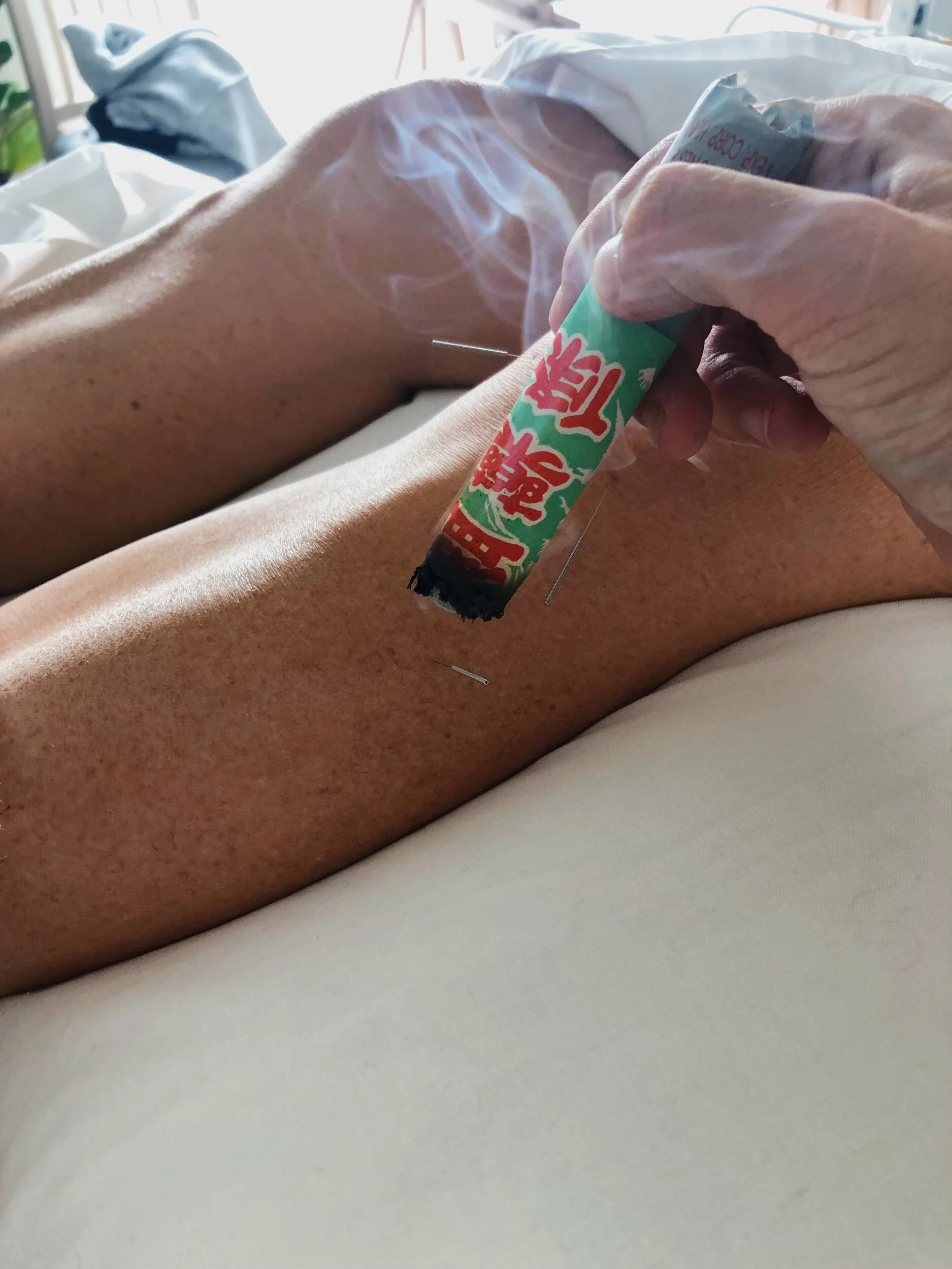 Acupuncture South East London