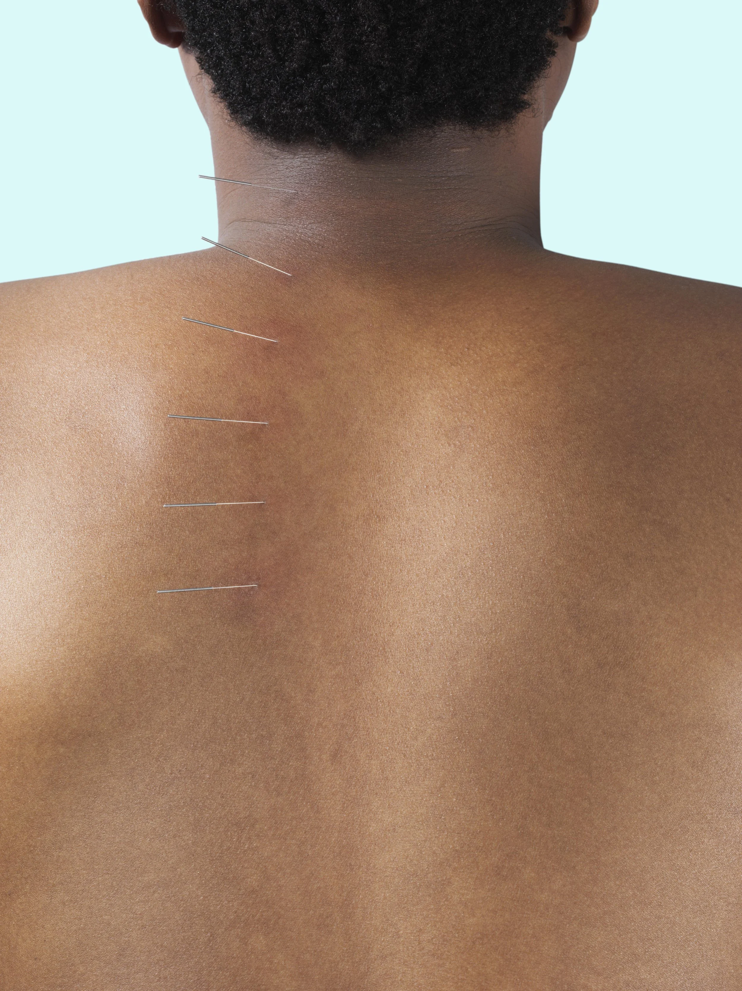 RFee_Acupuncture_MaleBackLine_Simple.jpg