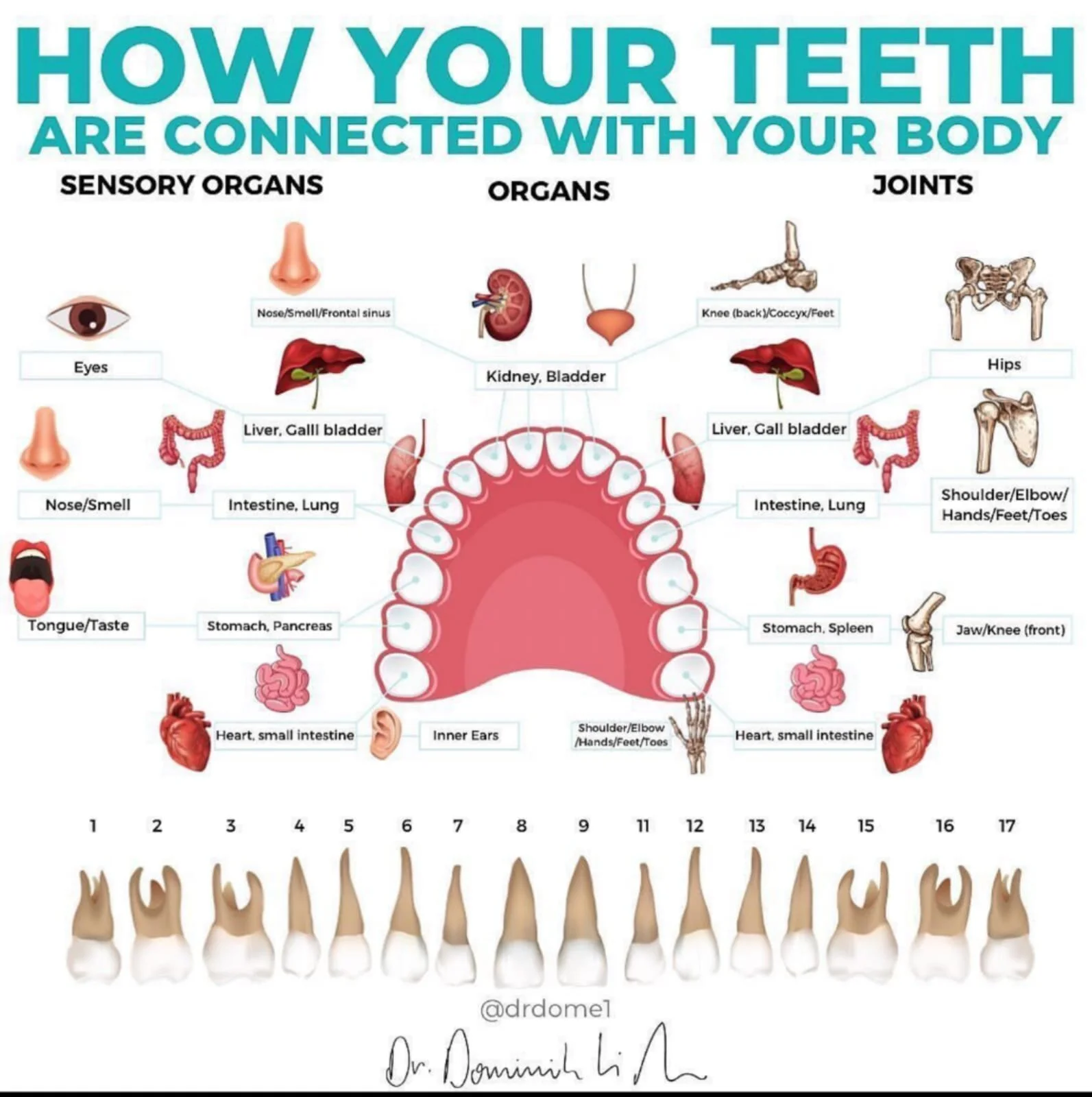 Why I Had Proactive Dental Surgery