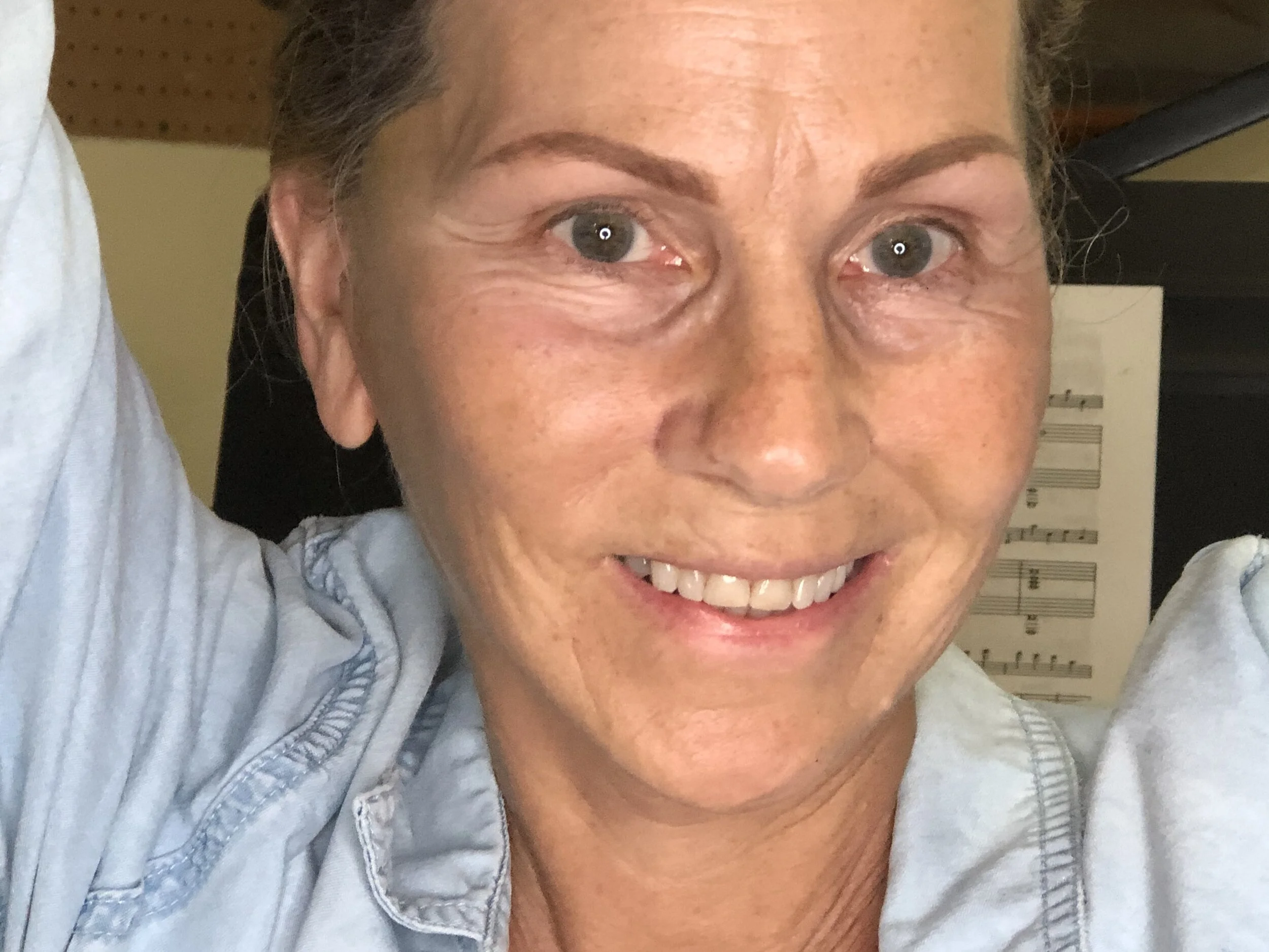 Facelift Post-Op:  Week Three...10 More Lessons