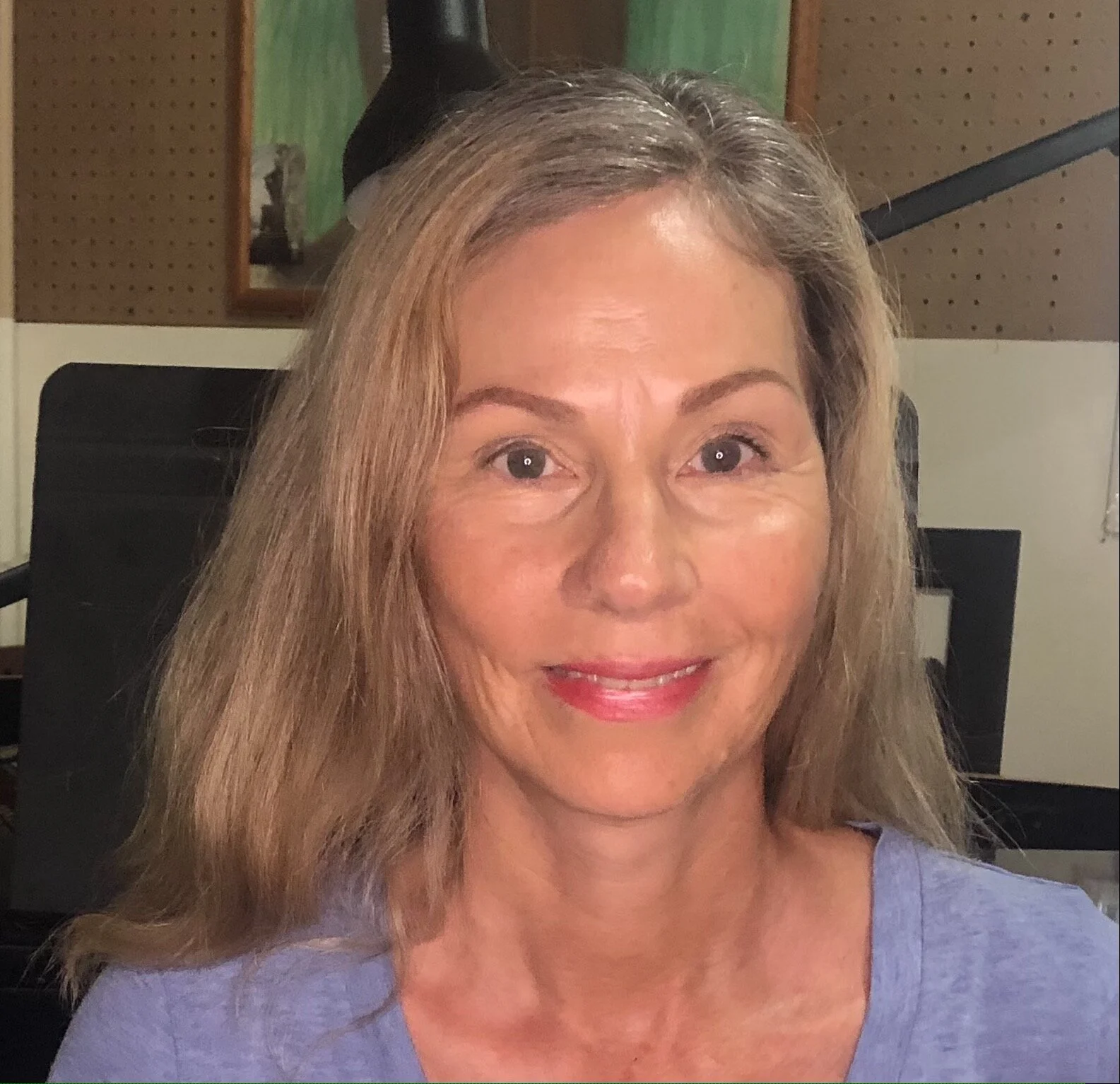 FACELIFT POST-OP:  Looks good.  Still feels weird.