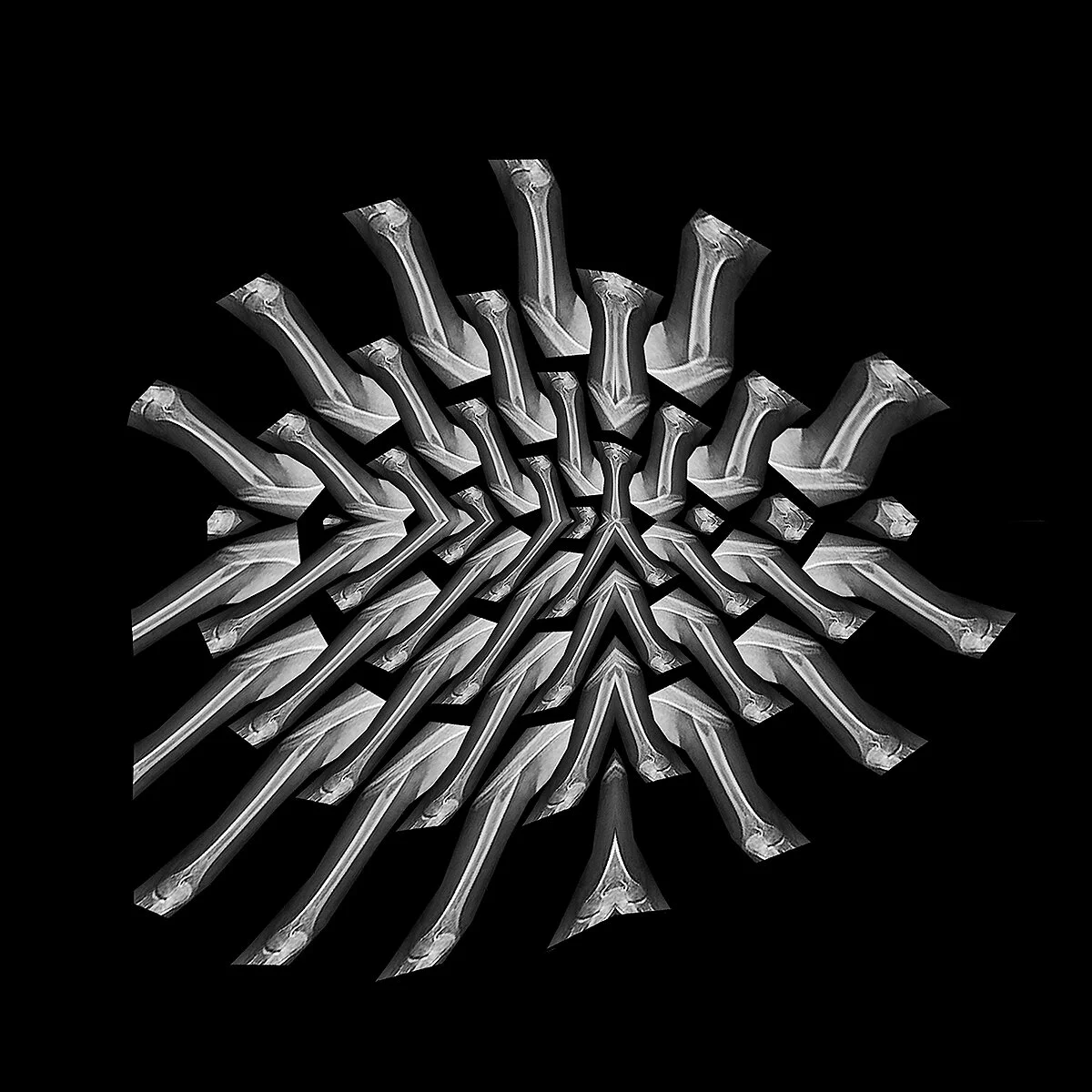 Ann's broken arm -  #1 .jpg