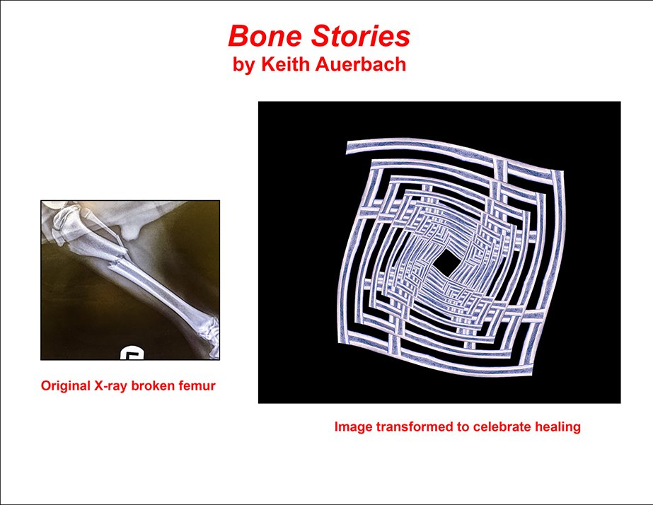 Bone Stories - 3 .jpg