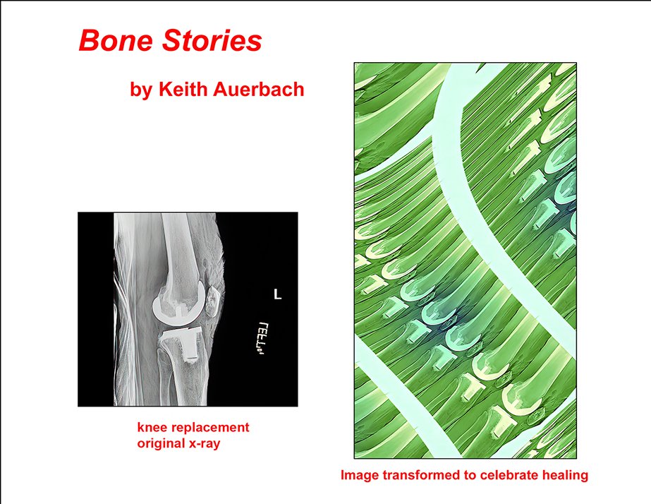 Bone Stories - 2 .jpg