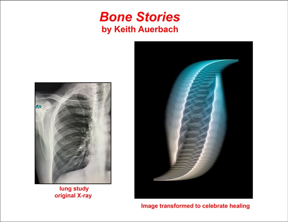 Bone Stories - 4 .jpg