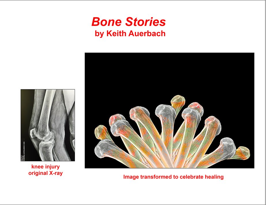 Bone Stories - 5 .jpg