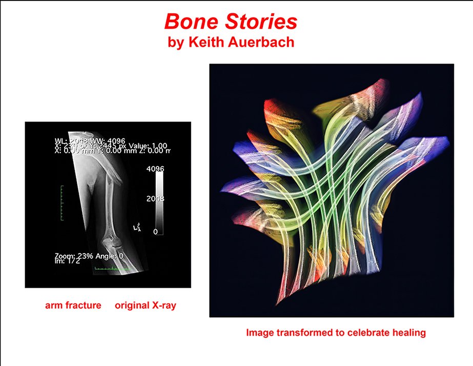 Bone Stories -1 .jpg