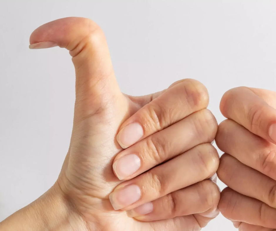 EDS vs. Hypermobility: What's the Difference, and Why Does Your Pelvic Floor Care?