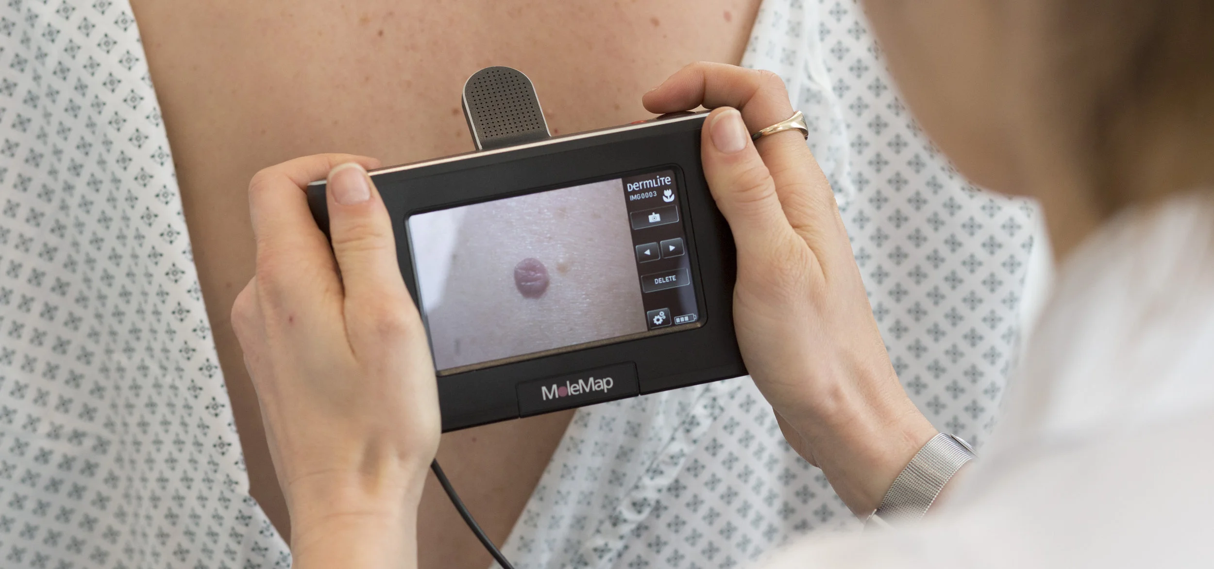 AI being used for cancer classification and diagnosis