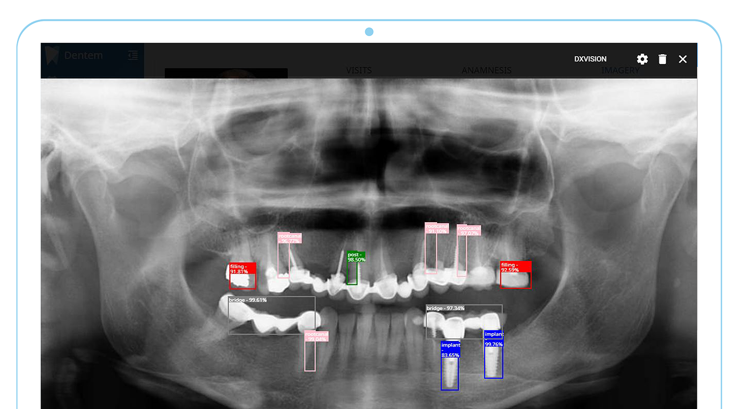 Dentem functioning by identifying and scanning a patient's teeth.