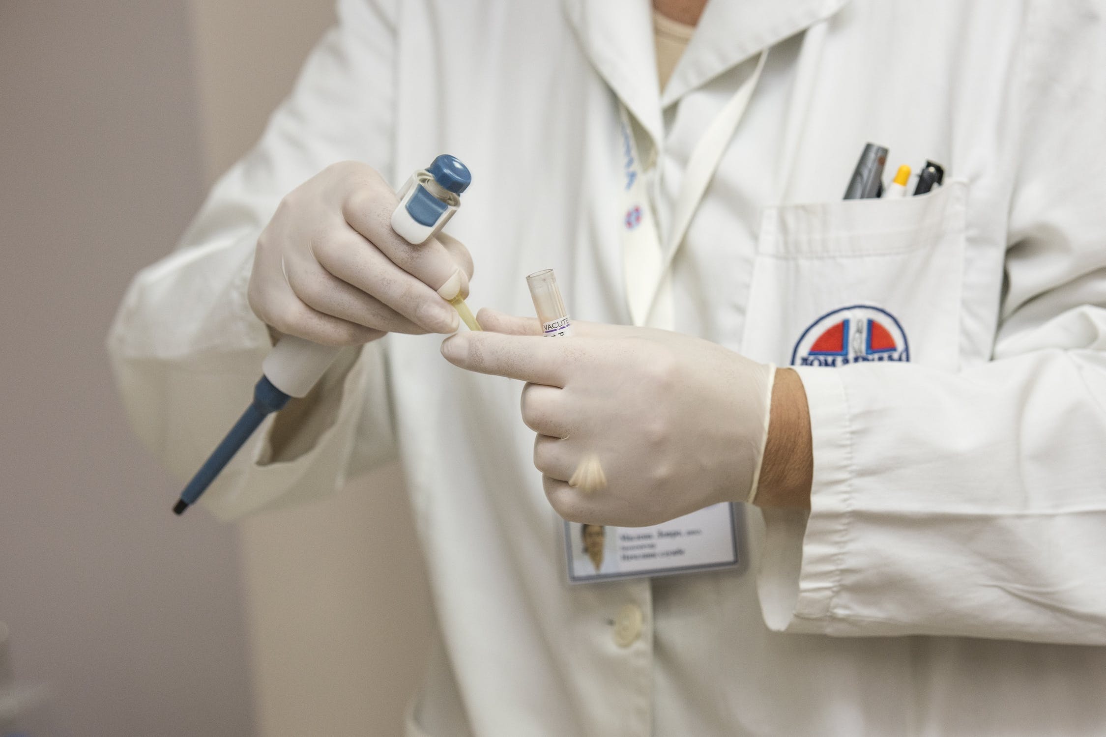 AI capable of predicting 90.2% of acute kidney injury cases earlier.