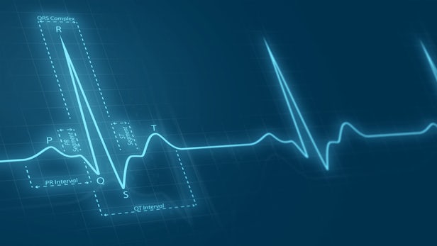 What if a Sinus Rhythm ECG could show Atrial Fibrillation? 