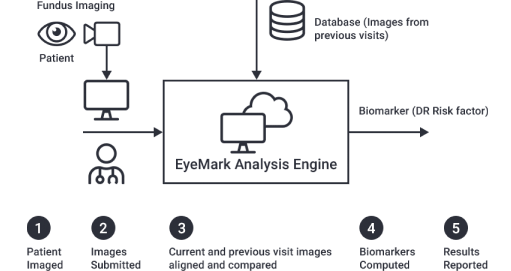 Promotional imaging on the company’s website, revealing EyeArt™’s steps in fully automated diabetic retinopathy analysis Credit: Eyenuk, Inc
