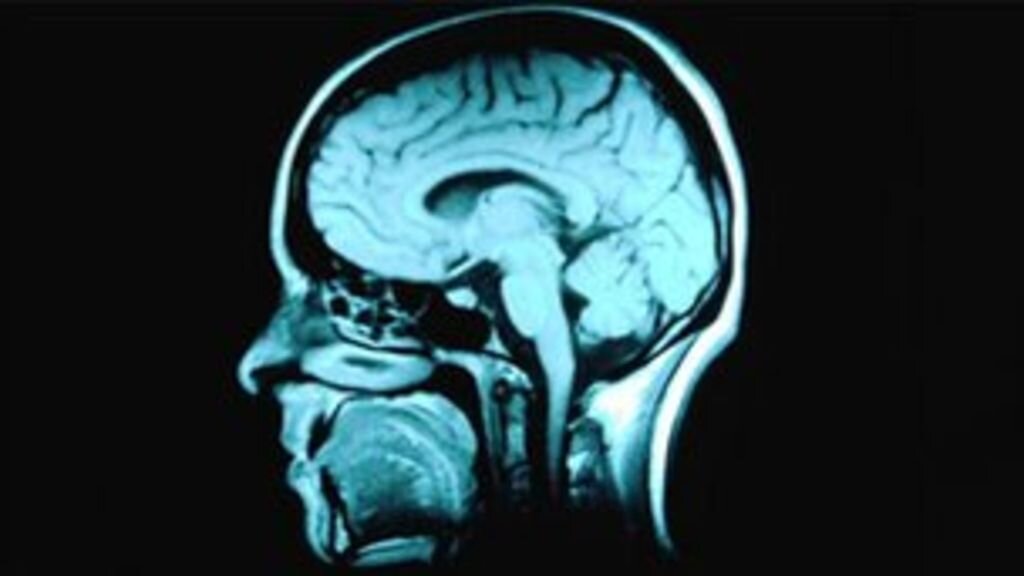 Other MRI scans can produce images of other areas of the body including the brain. Source: BBC News