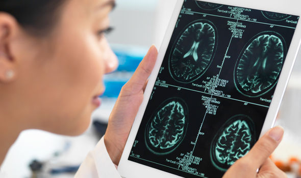 Dementia symptoms: Vascular dementia is the second most common type after Alzheimer's disease. Credit: Getty Images