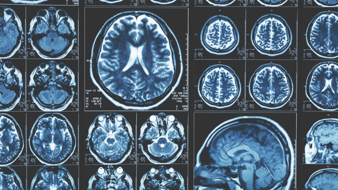 Medical Imaging with AI - Not As Reliable As We Think?