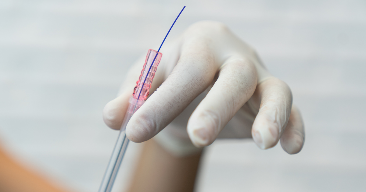 Mint PDO Threads Before and After: A Comprehensive Overview