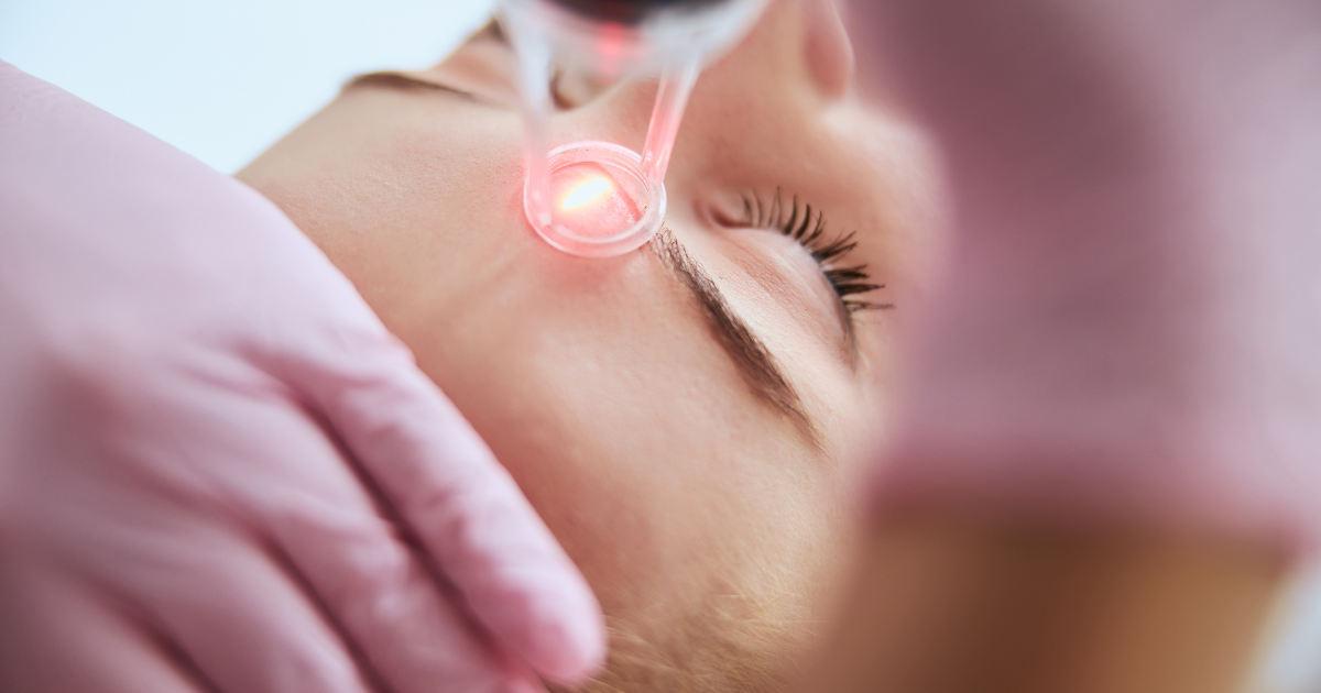 What is Smartskin CO2 Laser?