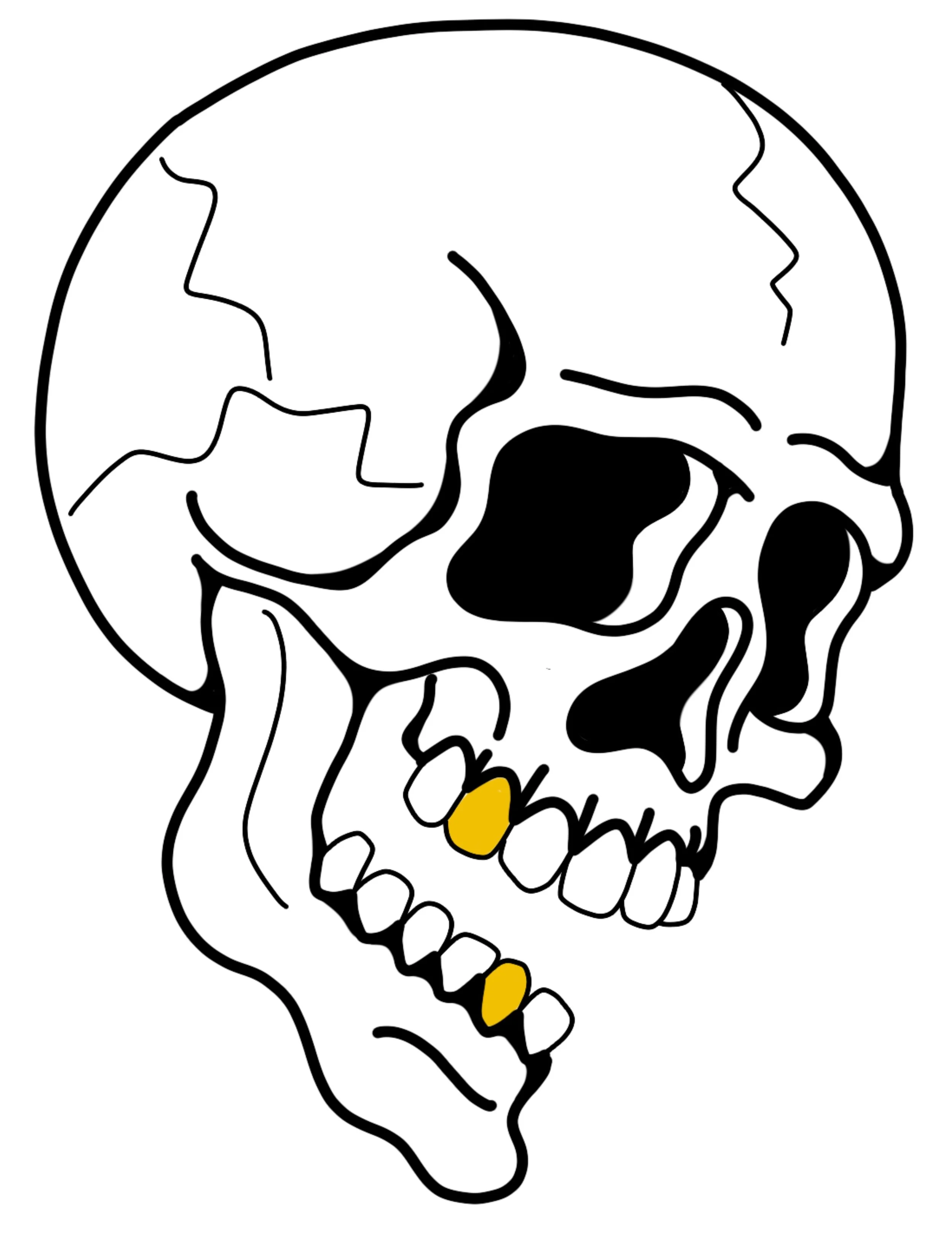 skull_dent_or.jpg