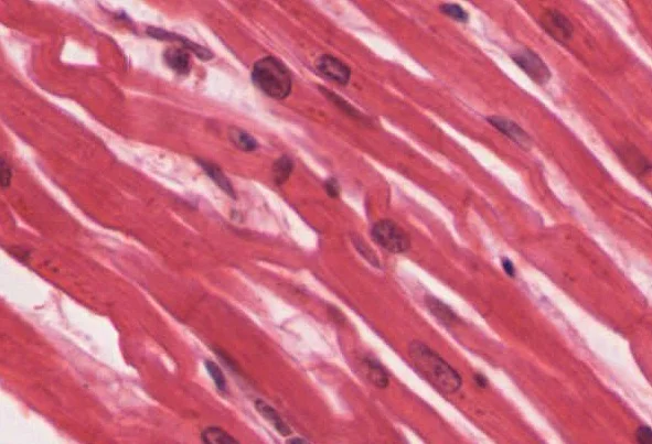 cardiac muscle cells.jpg