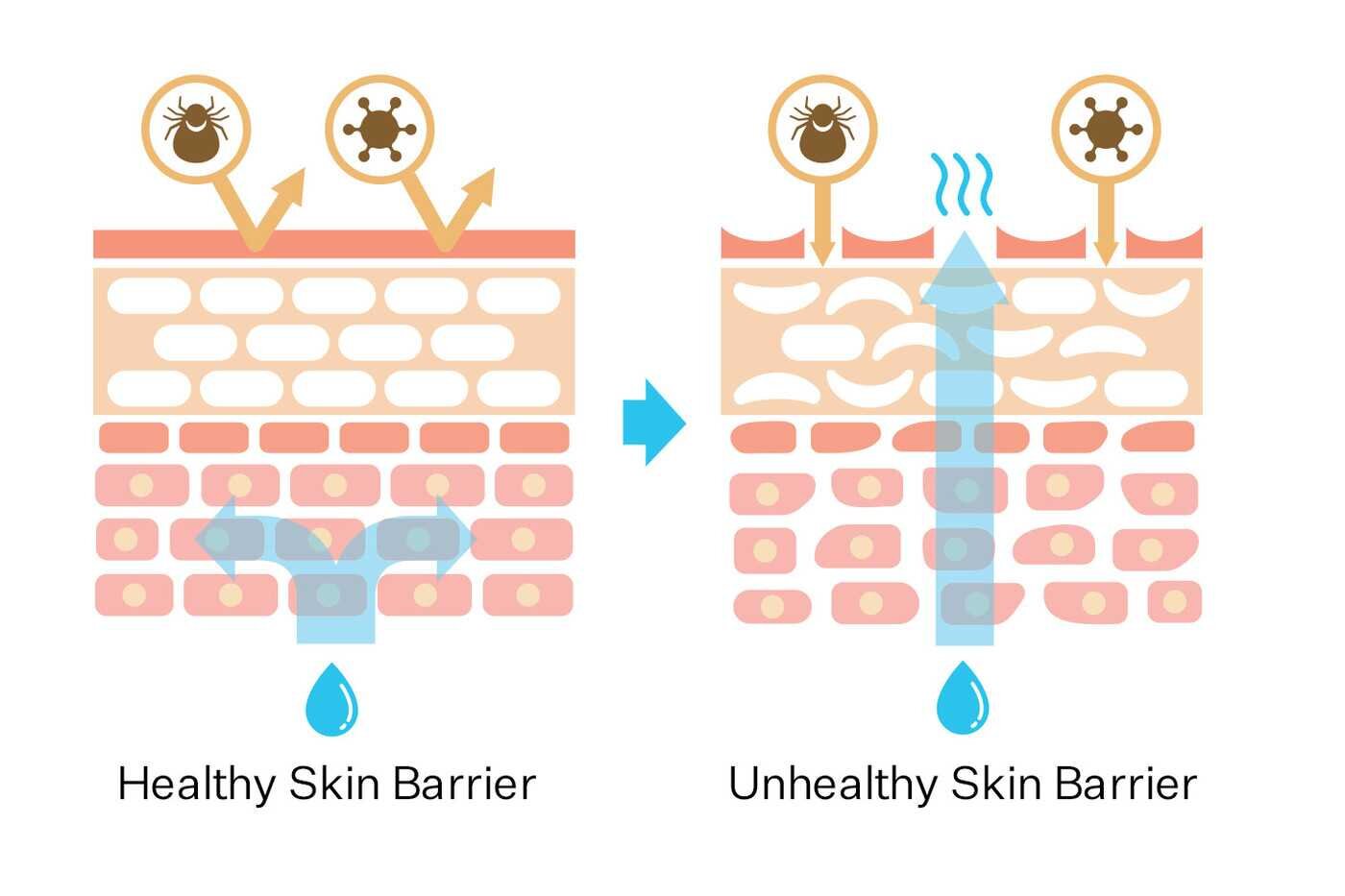 9451ad19b01be775502d944f6ce91ea1de09e326_article_name_blog_wide_banner_skin_barrier.jpg