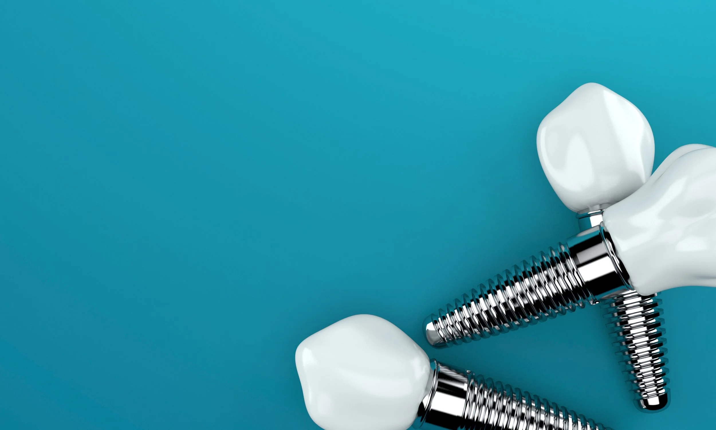 Dental Implants