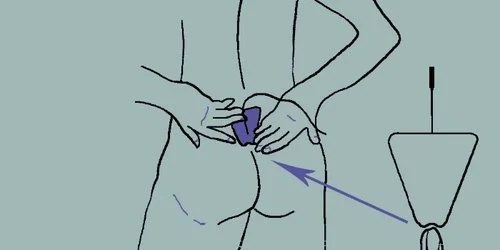 Pf Pad Placement How To Use A Tens Machine