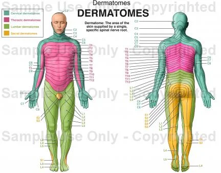 Dermatomes.jpg