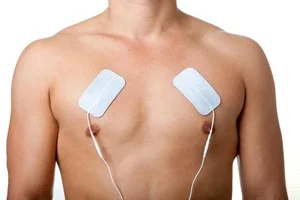 Pectoral_muscle_electrode_placement.jpg