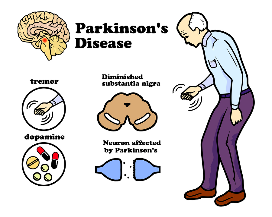 PARKINSONS DISEASE