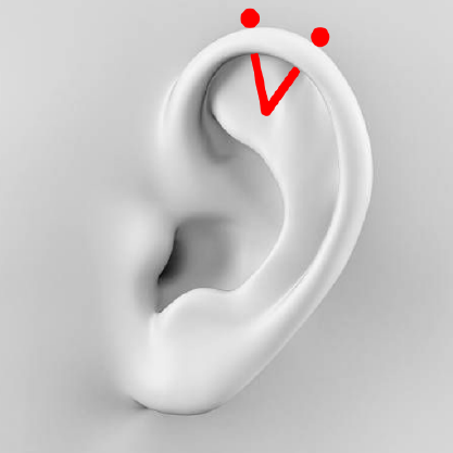 Orbital Piercing This piercing is when one piece of jewellery goes through two (or sometimes more) piercings. It's commonly done in the lobes, but can sit anywhere else in the ear as well.