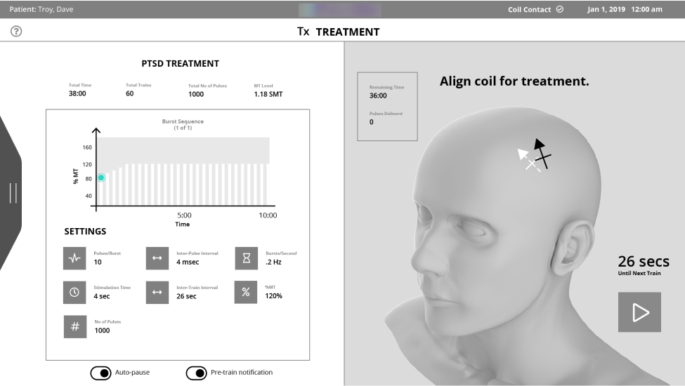 Wireframe-Treatment.png