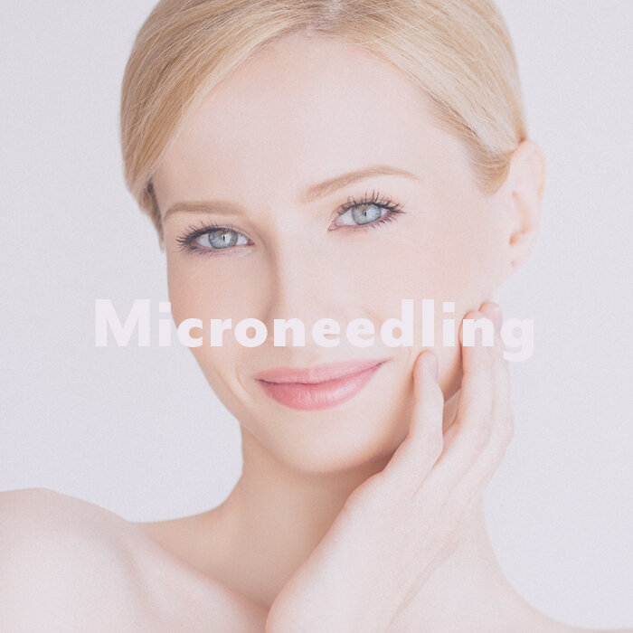 microneedling.jpg