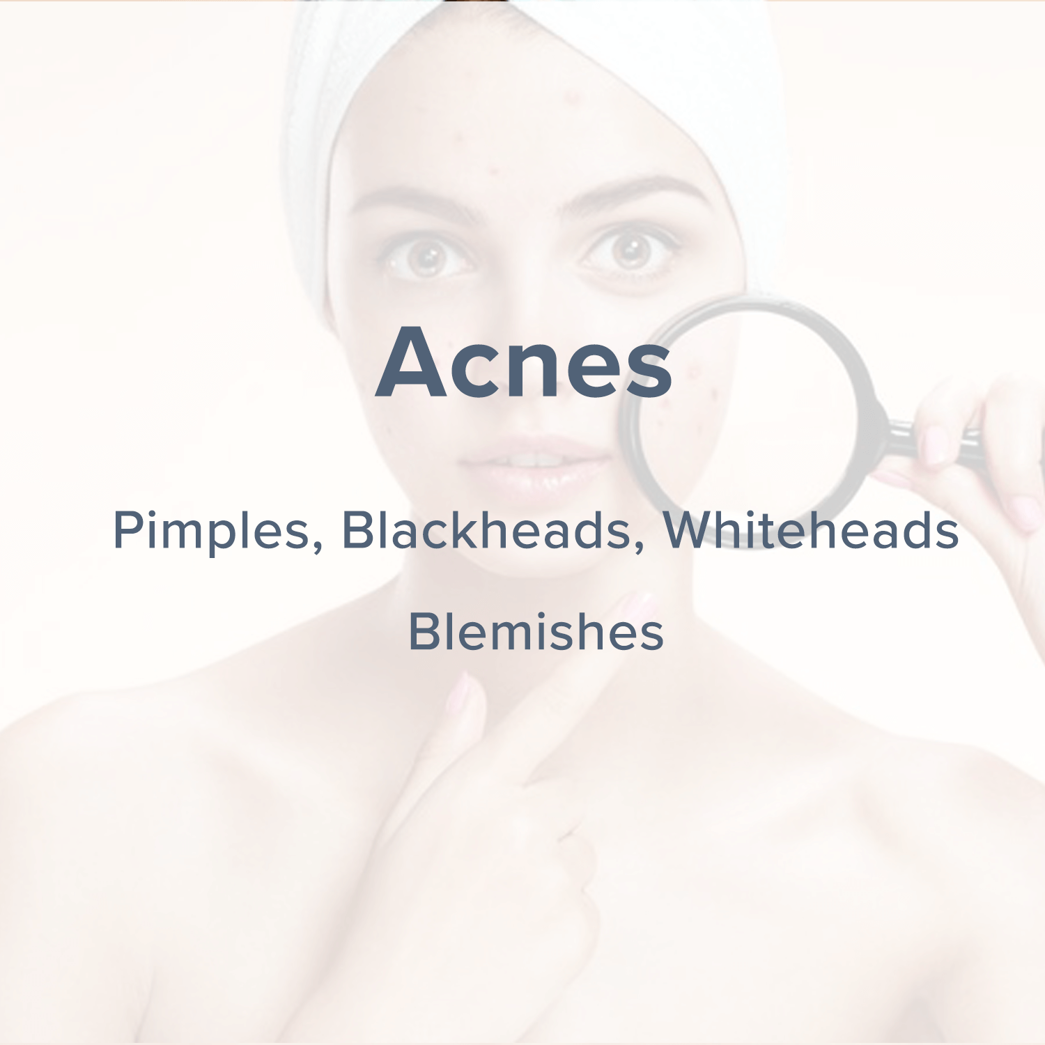 acne-cover.png