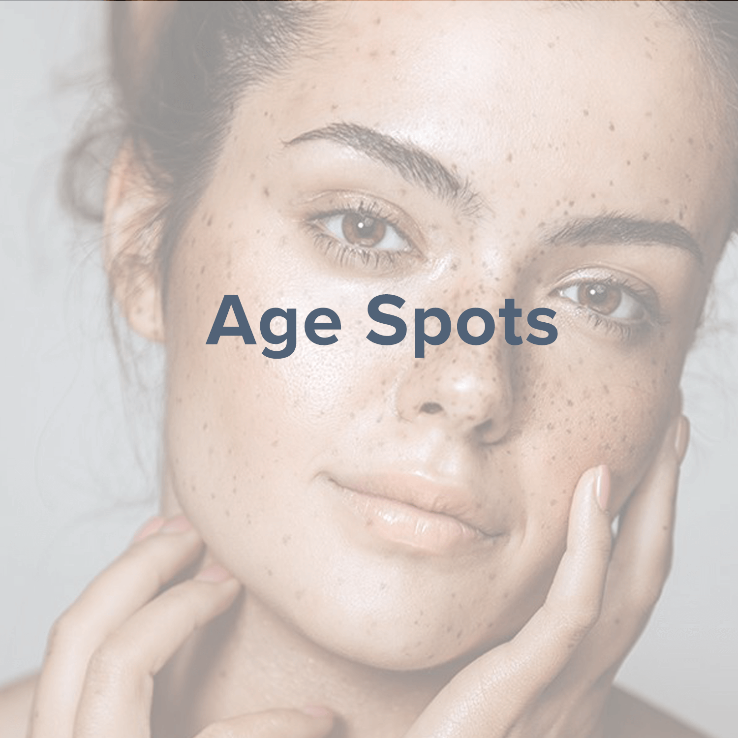 age-spots.png