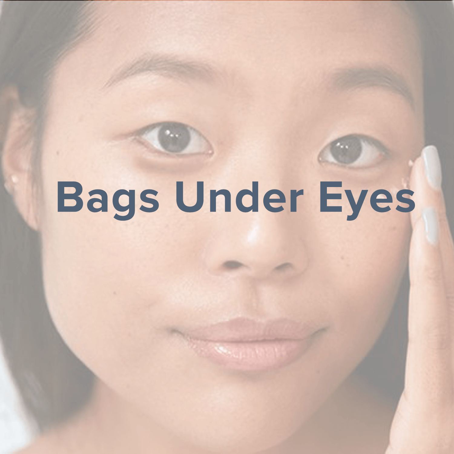bags-under-eyes.png