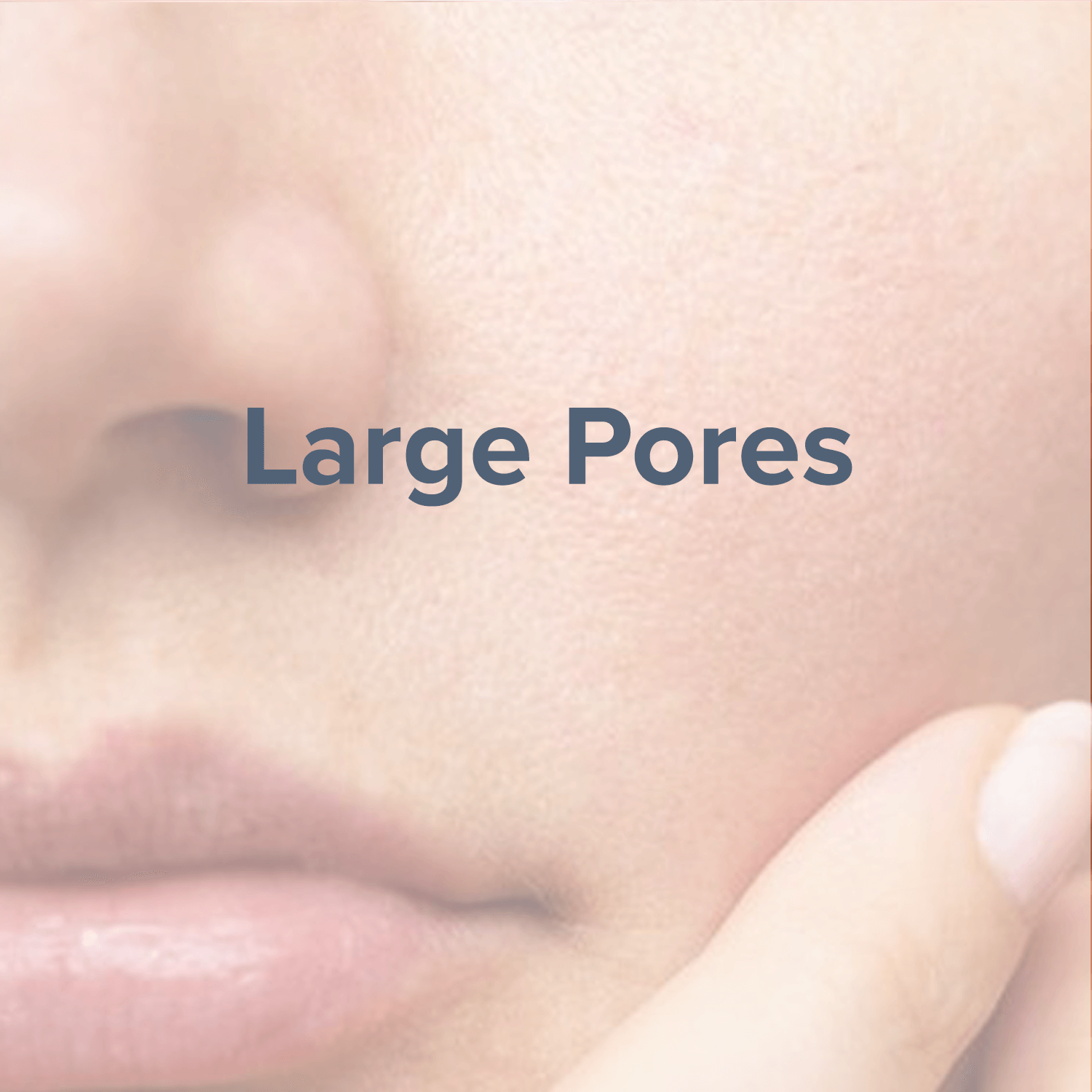 large-pores.png