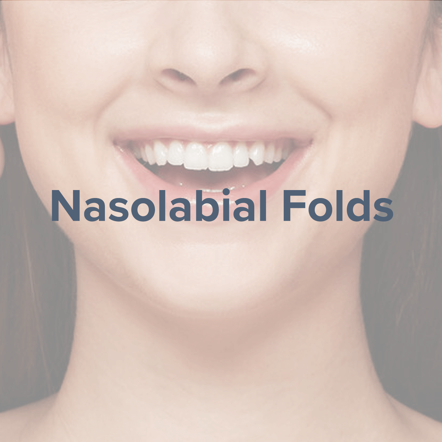 nasolabial-folds.png